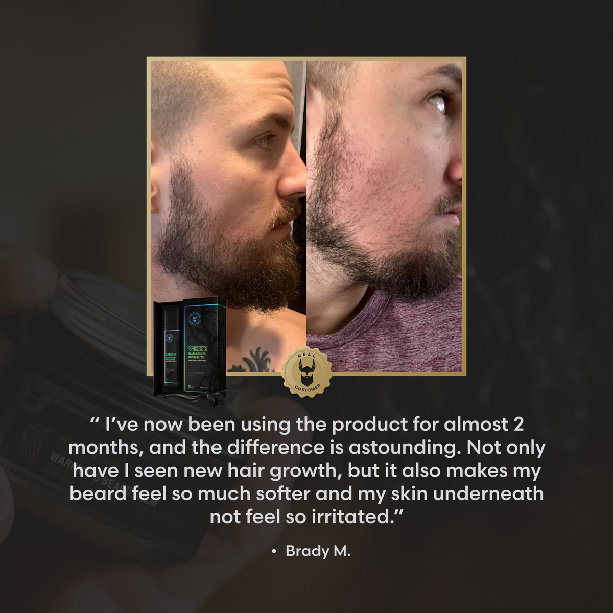 Voxtr Beard Growth Serum
