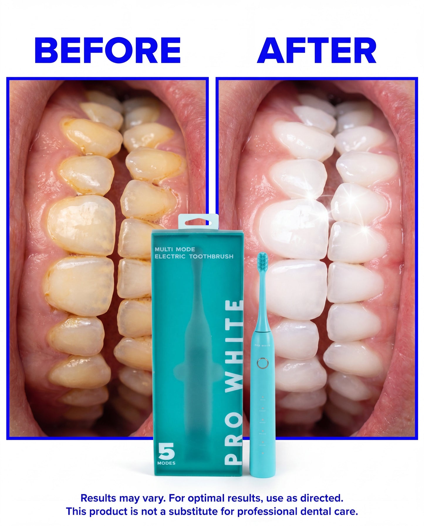 Multi-Mode Sonic Electric Toothbrush