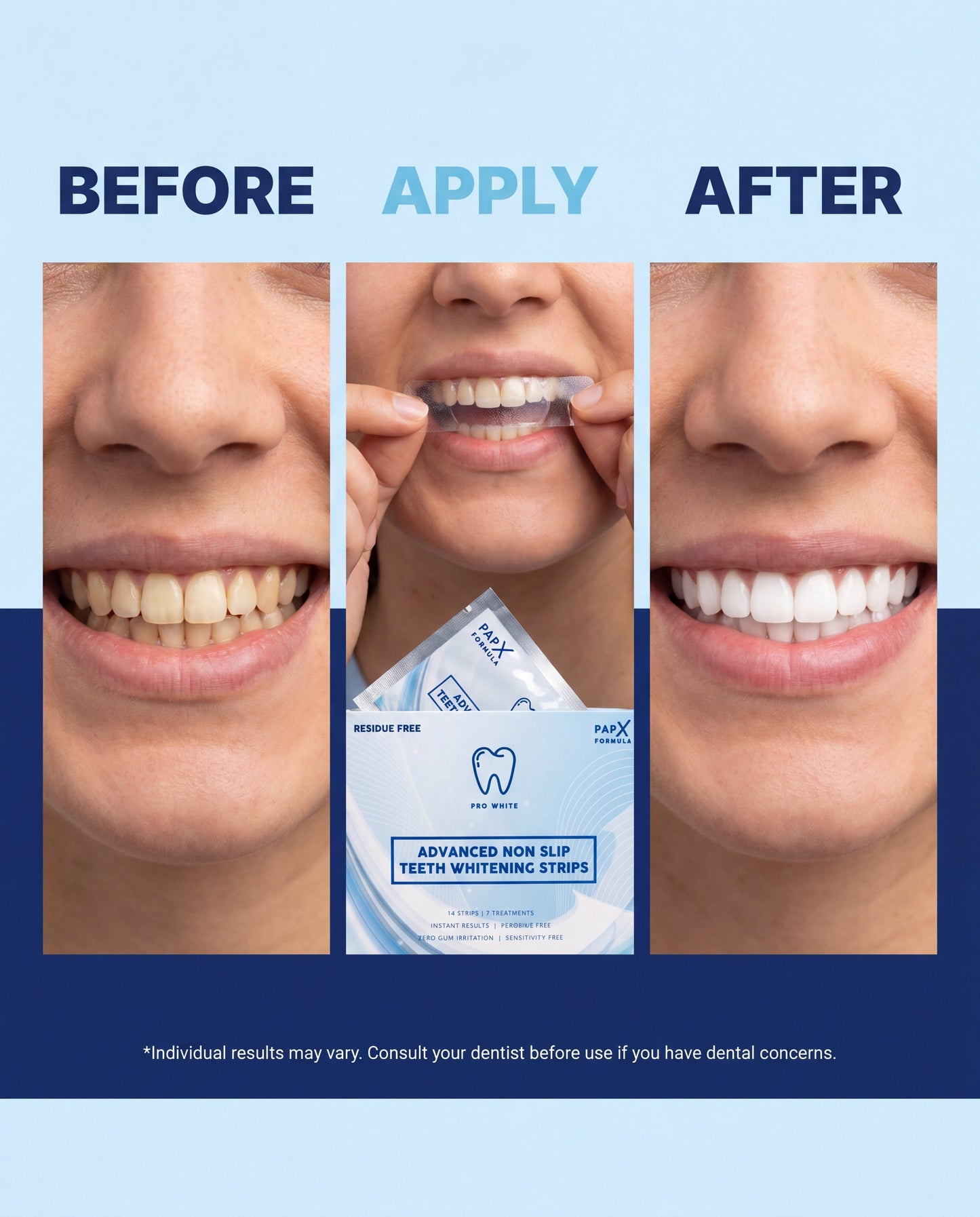 PAP-X™ Advanced Non-Slip Teeth Whitening Strips