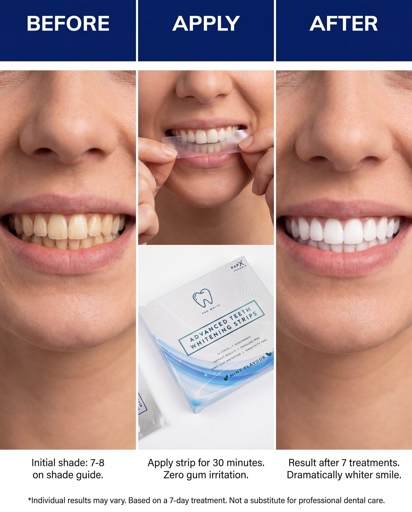 PAP-X™ Advanced Teeth Whitening Strips