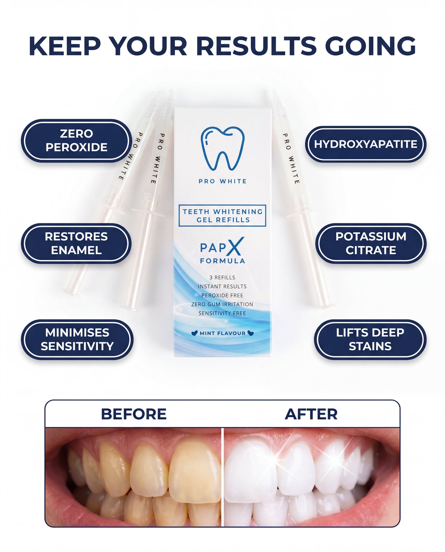 PAP-X™ Teeth Whitening Refills