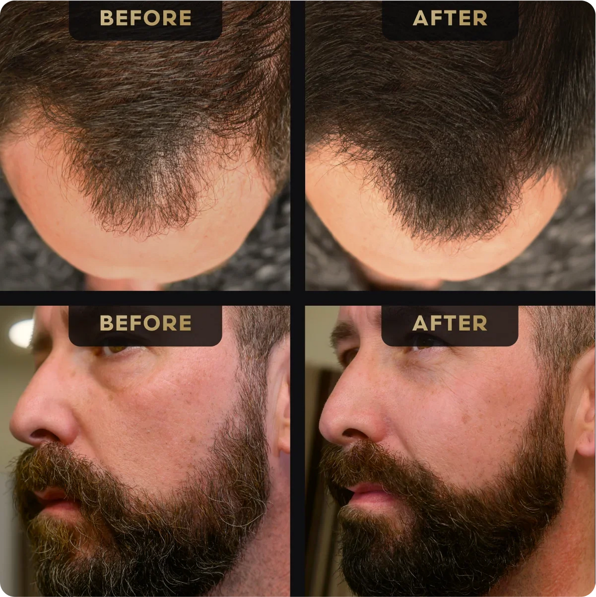 Baldr's Beard Pen + Hair Concealer Bundle